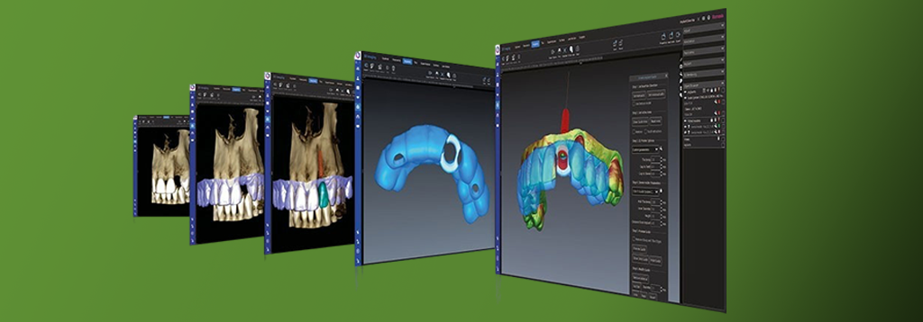 PC Custom pentru imagistica dentara– Stații de lucru optimizate pentru performanță maximă